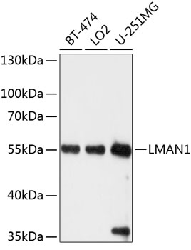 Anti-LMAN1 Antibody