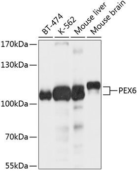 Anti-PEX6 Antibody
