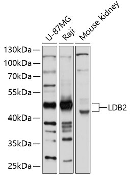 Anti-LDB2 Antibody