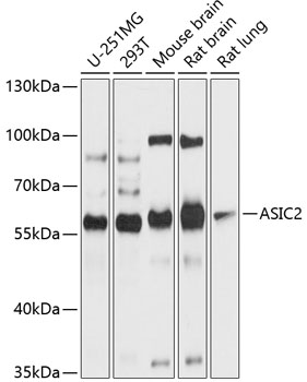 Anti-ASIC2 Antibody