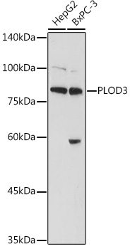 Anti-PLOD3 Antibody