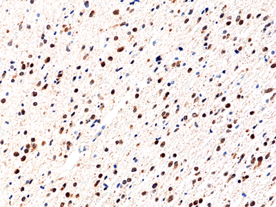 Anti-IDH1 (R132H mutant) Antibody [RM390]
