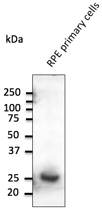 Anti-RAB31 Antibody