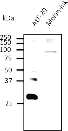 Anti-RAB27B Antibody