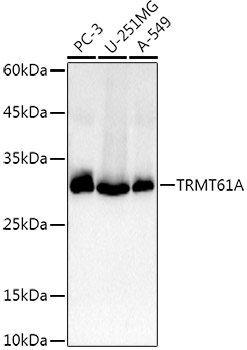 Anti-TRMT61A Antibody