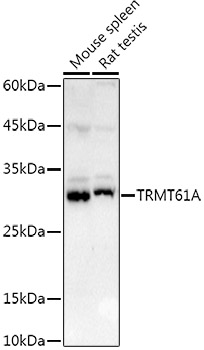 Anti-TRMT61A Antibody Anti-TRMT61A Antibody