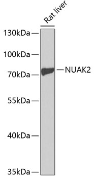 Anti-NUAK2 Antibody