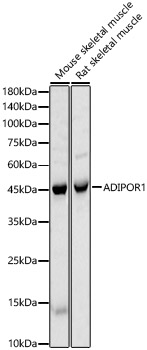 Anti-ADIPOR1 Antibody