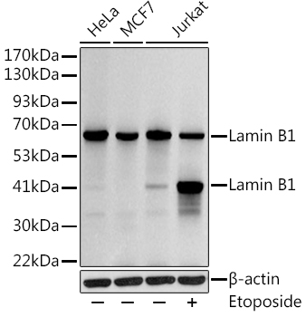 Anti-Lamin B1 Antibody