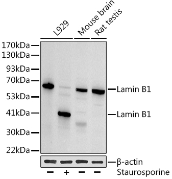 Anti-Lamin B1 Antibody Anti-Lamin B1 Antibody
