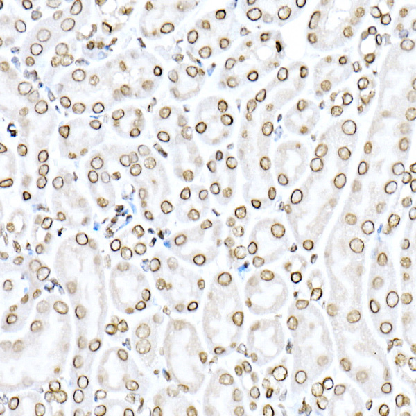 Anti-Lamin B1 Antibody Anti-Lamin B1 Antibody