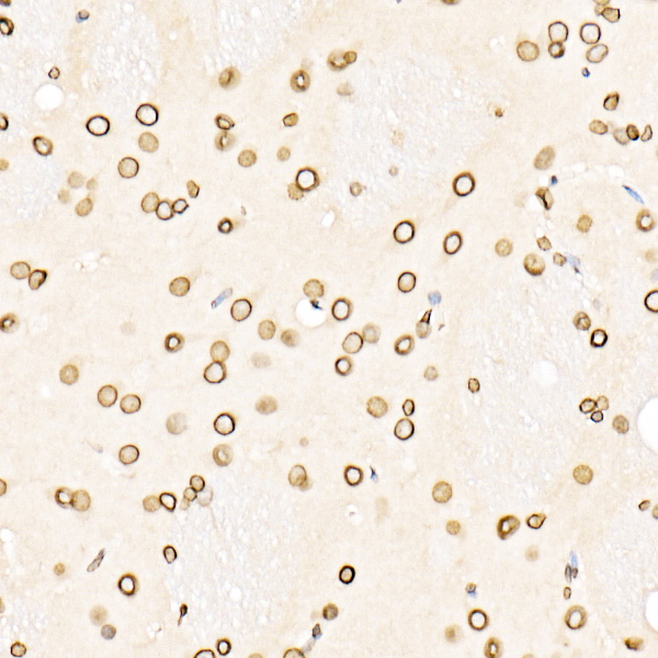 Anti-Lamin B1 Antibody Anti-Lamin B1 Antibody