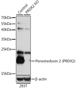 Anti-Peroxiredoxin 2 / PRP Antibody