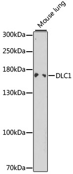 Anti-DLC1 Antibody