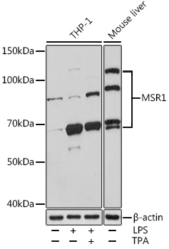 Anti-CD204 Antibody
