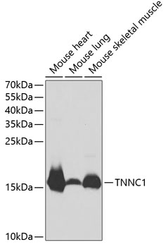 Anti-TNNC1 Antibody - Identical to Abcam (ab180732)