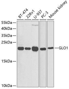Anti-GLO1 Antibody