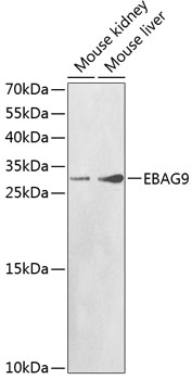 Anti-EBAG9 Antibody