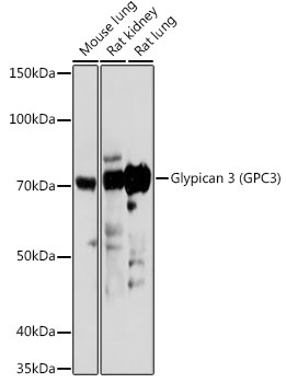 Anti-Glypican 3 Antibody