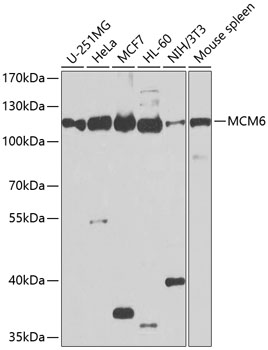Anti-MCM6 Antibody