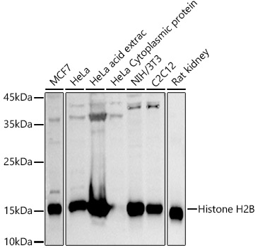 Anti-Histone H2B Antibody