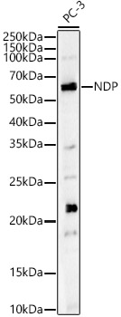 Anti-NDP Antibody - Identical to Abcam (ab185715)