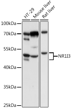 Anti-Constitutive androstane receptor Antibody - Identical to Abcam (ab186869)