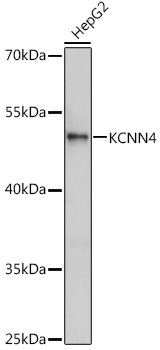 Anti-KCNN4 Antibody