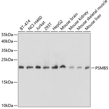 Anti-PSMB5 / MB1 Antibody