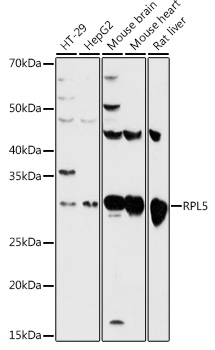 Anti-RPL5 Antibody - Identical to Abcam (ab186857)