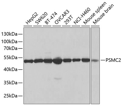 Anti-MSS1 Antibody