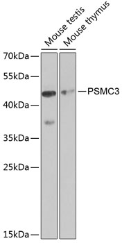 Anti-TBP-1 Antibody - Identical to Abcam (ab185730)