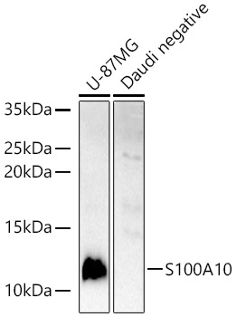 Anti-S100A10 Antibody