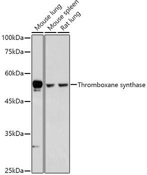 Anti-Thromboxane synthase Antibody