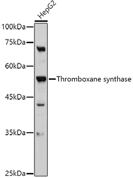 Anti-Thromboxane synthase Antibody Anti-Thromboxane synthase Antibody