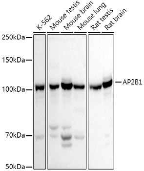 Anti-AP2B1 Antibody
