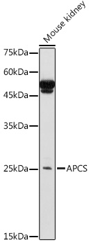 Anti-Serum Amyloid P / SAP Antibody
