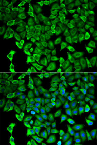 Anti-Proteasome 26S S2 / PSMD2 Antibody - Identical to Abcam (ab197054) Anti-Proteasome 26S S2 / PSMD2 Antibody - Identical to Abcam (ab197054)