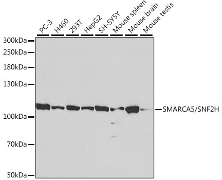 Anti-SNF2H Antibody