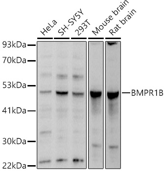 Anti-BMPR1B Antibody - Identical to Abcam (ab175385)
