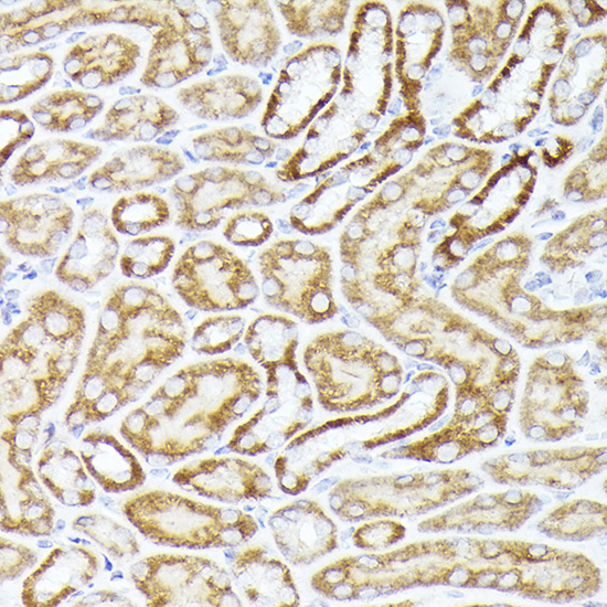 Anti-BMPR1B Antibody - Identical to Abcam (ab175385) Anti-BMPR1B Antibody - Identical to Abcam (ab175385)