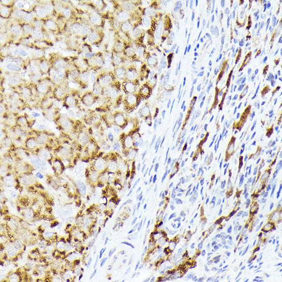 Anti-BMPR1B Antibody - Identical to Abcam (ab175385) Anti-BMPR1B Antibody - Identical to Abcam (ab175385)