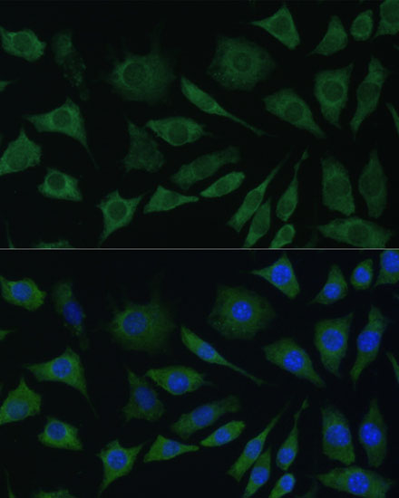 Anti-BMPR1B Antibody - Identical to Abcam (ab175385) Anti-BMPR1B Antibody - Identical to Abcam (ab175385)