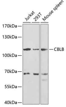Anti-CBLB Antibody