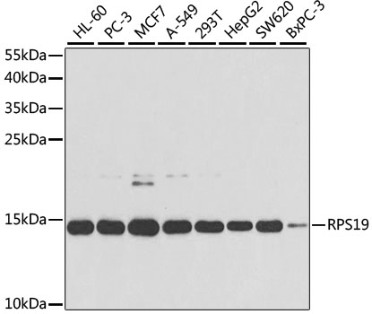 Anti-RPS19 Antibody