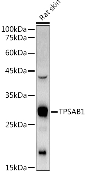Anti-Mast Cell Tryptase Antibody - Identical to Abcam (ab196772)