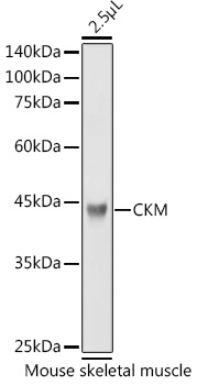 Anti-Creatine Kinase MM Antibody