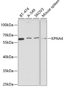 Anti-KPNA4 Antibody