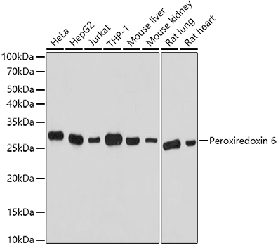 Anti-Peroxiredoxin 6 Antibody