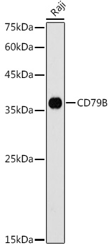 Anti-CD79b Antibody - Identical to Abcam (ab175399)